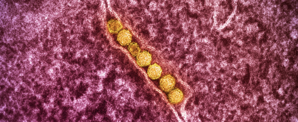 Virus du Nil occidental : trois cas en Loire-Atlantique, comment se protéger des moustiques ?