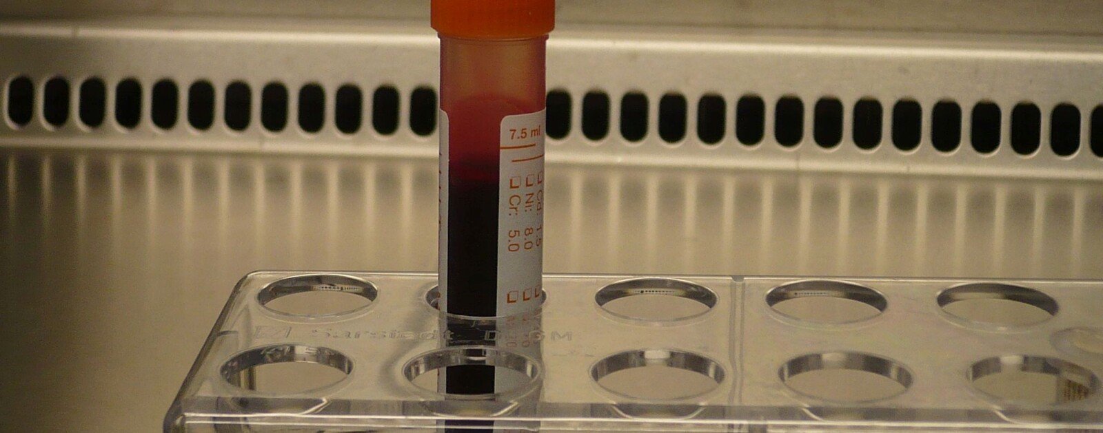 Tube de prélèvement sanguin dans un laboratoire d’analyses