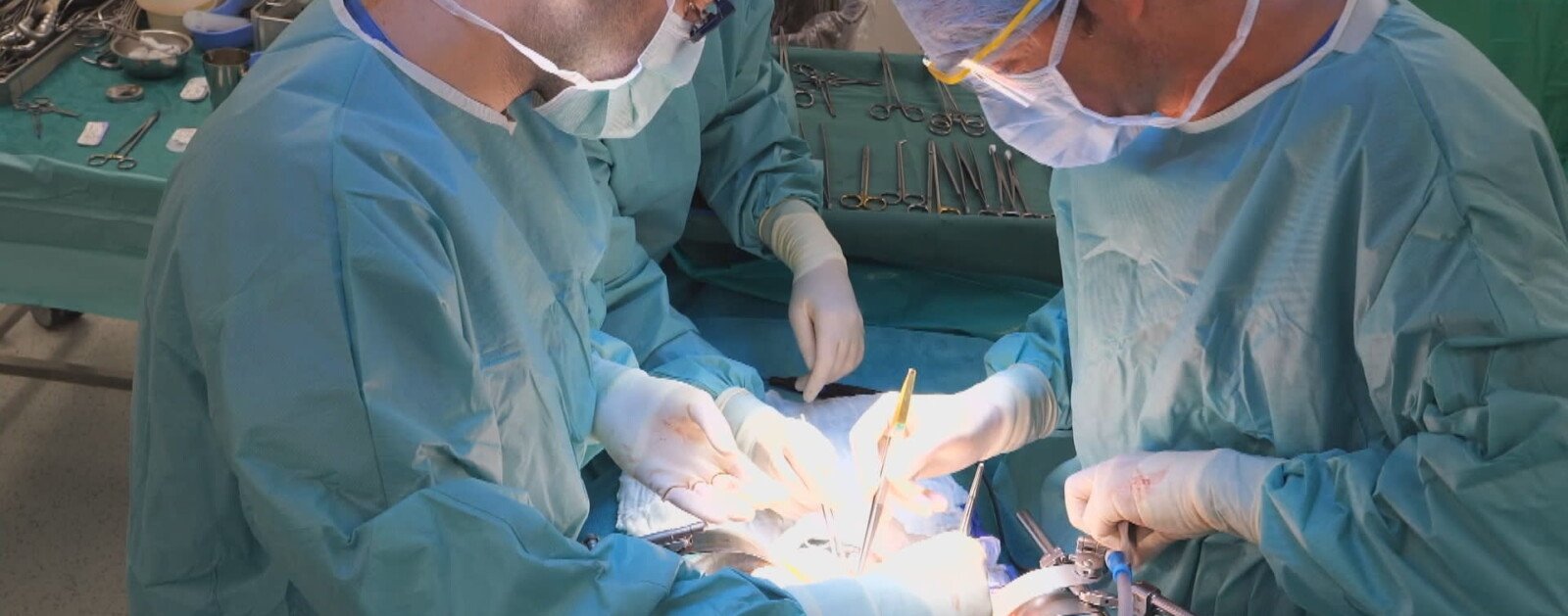Équipe chirurgicale réalisant une transplantation au bloc opératoire
